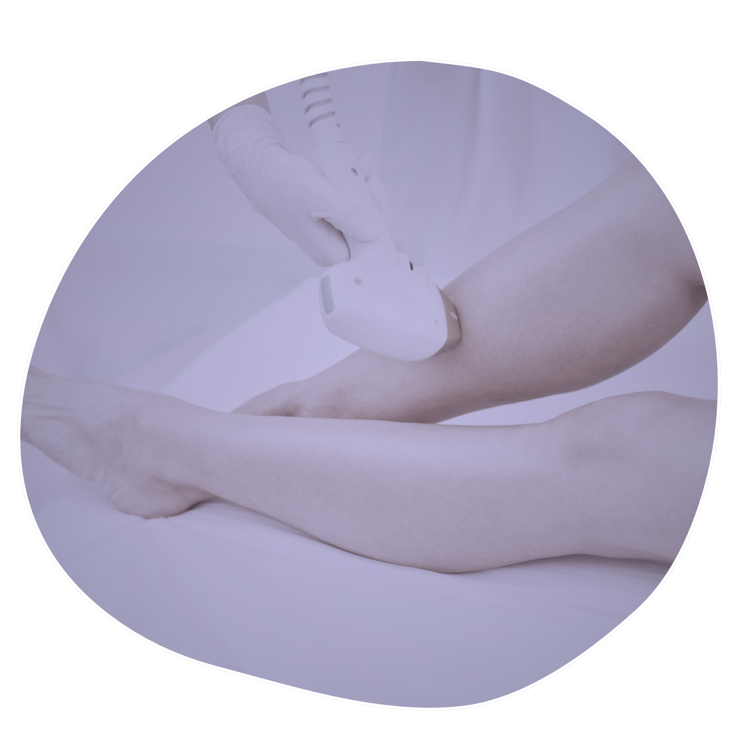 DEPILACIÓ LÀSER - Dermastètica